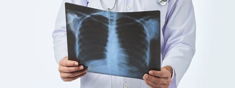 CT pluća - specijalistički pregled