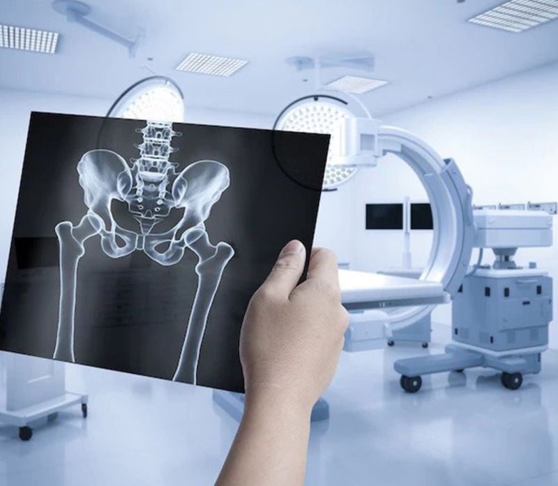 MRI Niš - Magnetna rezonanca kukova