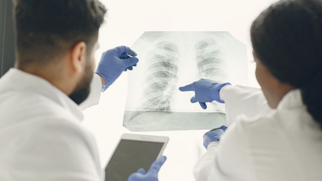 Benigni tumor pluća: Uzroci, simptomi i tretmani Benigni tumor pluća: Uzroci, simptomi i tretmani