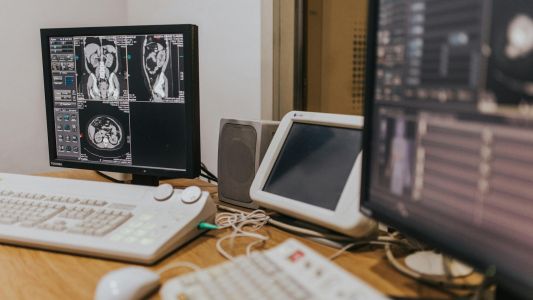 MSCT abdomena MSCT abdomena