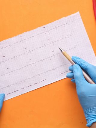 Kardiološki pregled i EKG holter