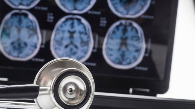 Encefalitis: dijagnoza i lečenje Encefalitis: dijagnoza i lečenje