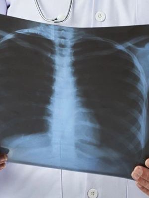 CT pluća - specijalistički pregled