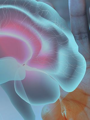 MRI Niš - Magnetna rezonanca glave